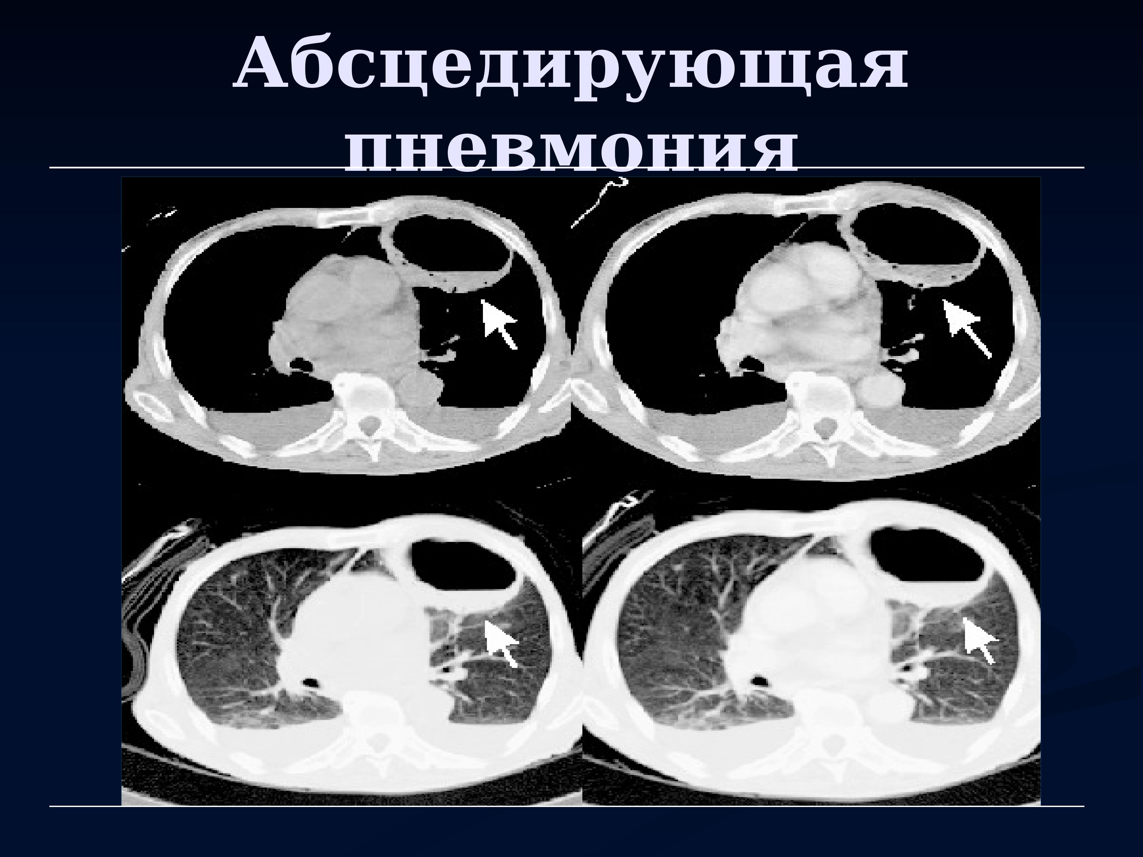 Лучевая диагностика органов дыхания презентация