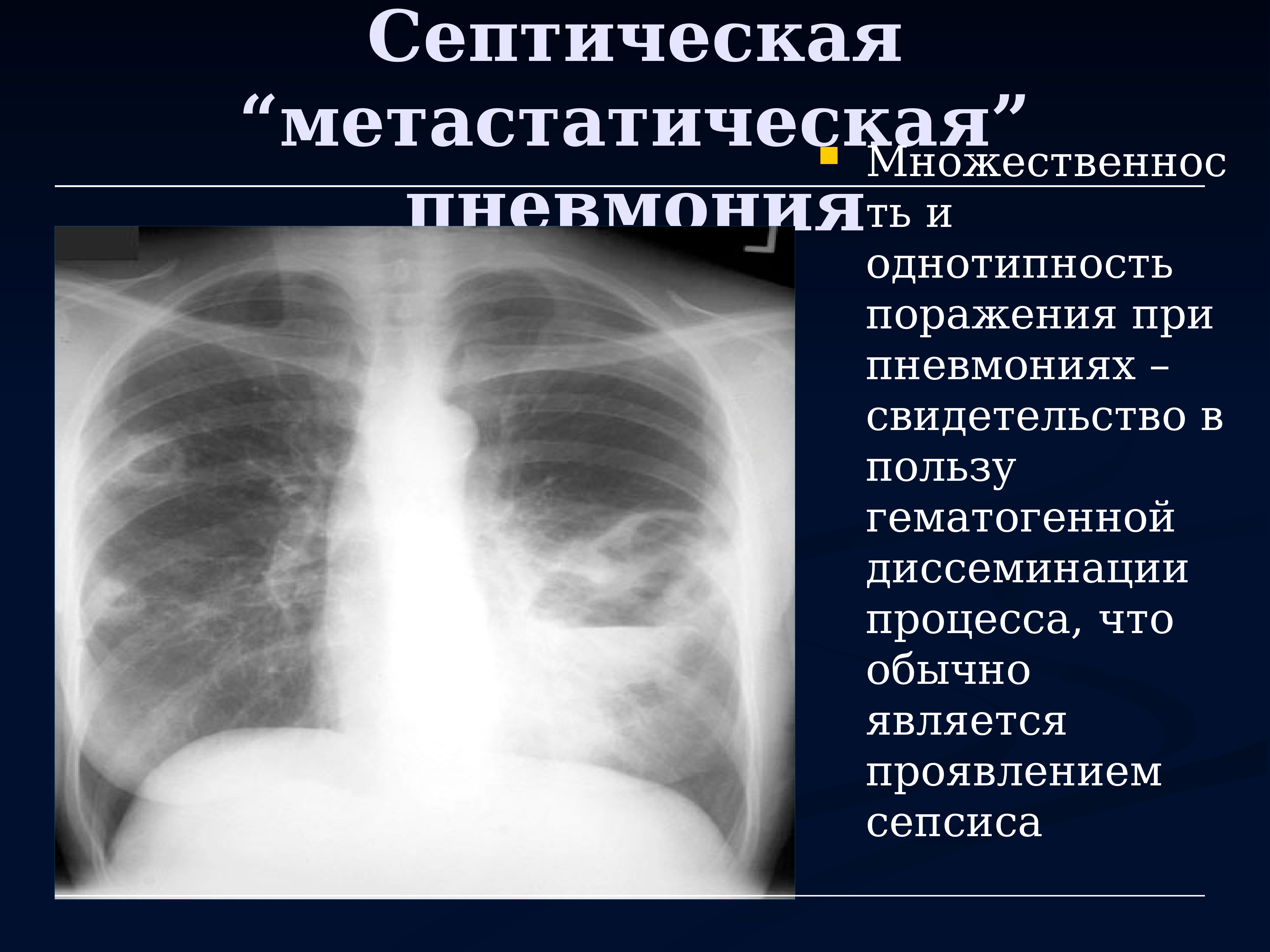 Лучевая диагностика органов дыхания презентация