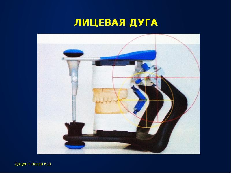 Окклюдатор и артикулятор презентация