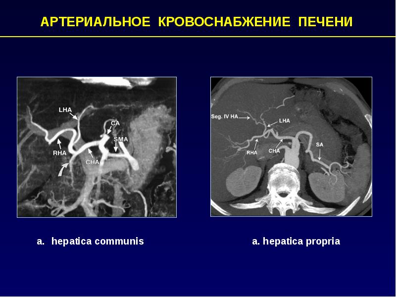 Компьютерная томография презентация