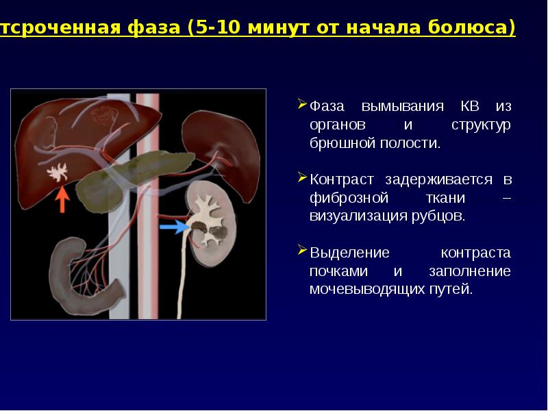 Компьютерная томография презентация