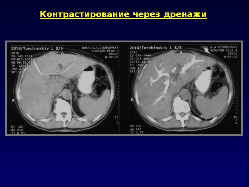 Компьютерная томография презентация