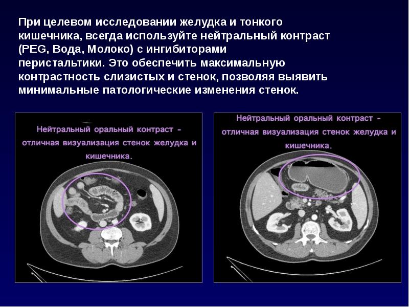 Компьютерная томография презентация