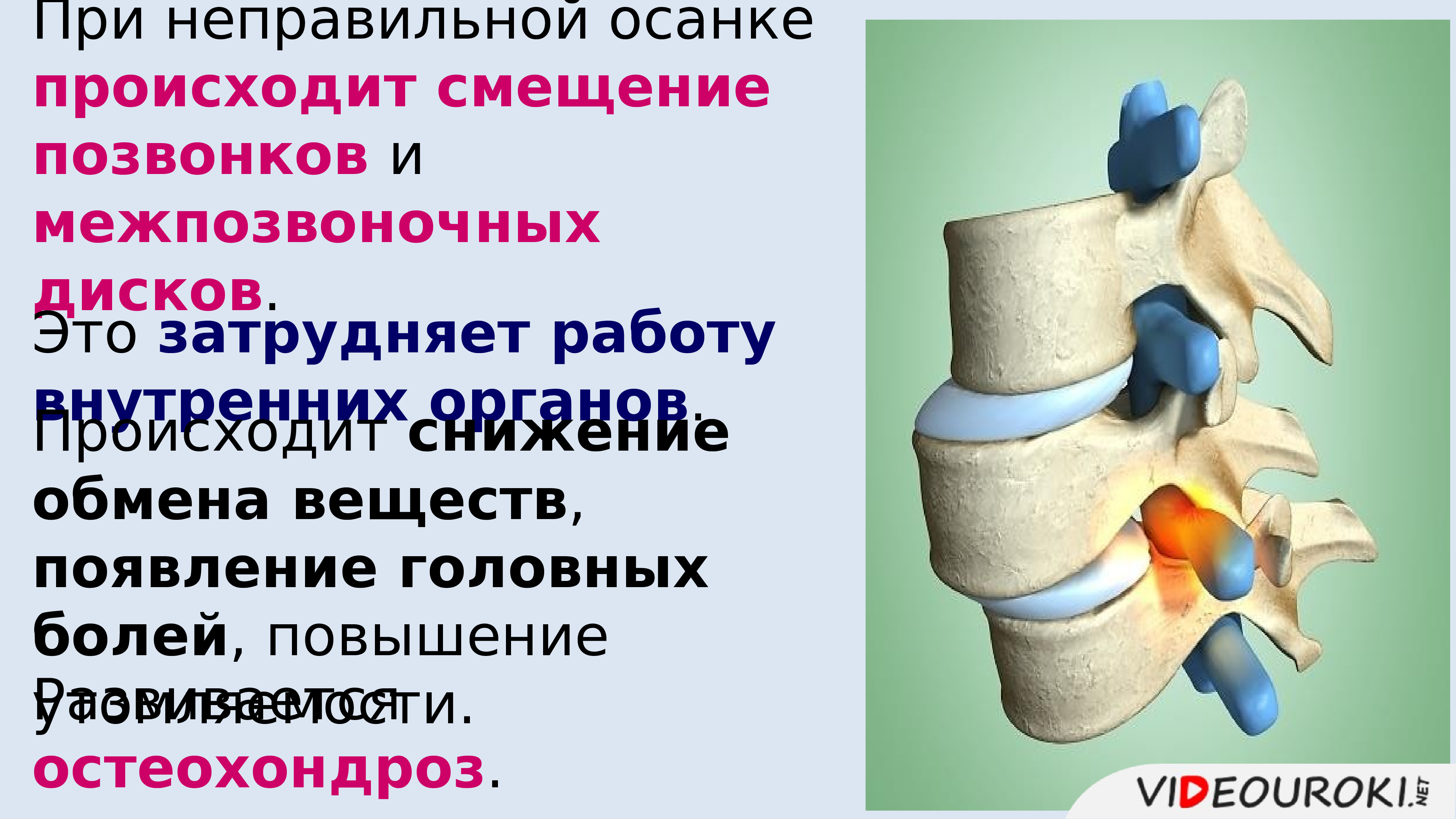 Нарушение осанки и плоскостопие презентация 8 класс биология пономарева