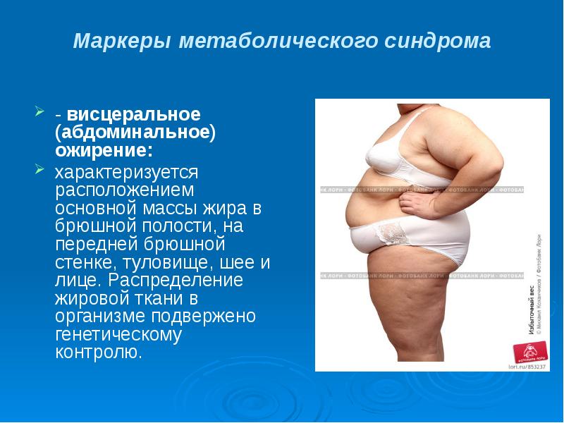 Абдоминальное ожирение что это. Ожирение метаболический синдром. Метаболический синдром висцеральный жир. Абдоминальное ожирение. Метаболический синдром у женщин.