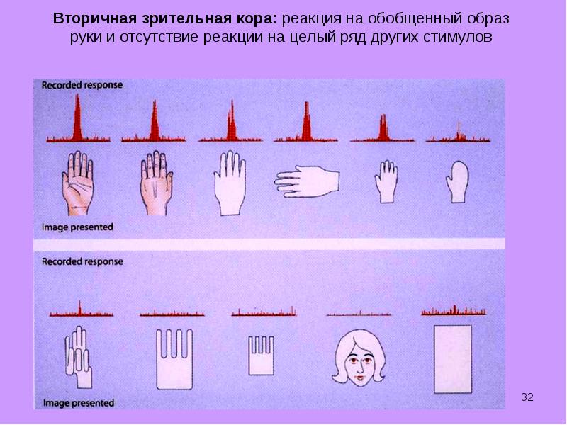 Целый реакция. Корковая реакция. Исследование реакции на зрительные стимулы на кошках.