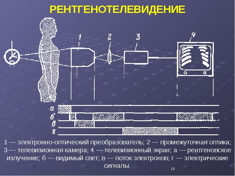 Информативность рентгеновского изображения