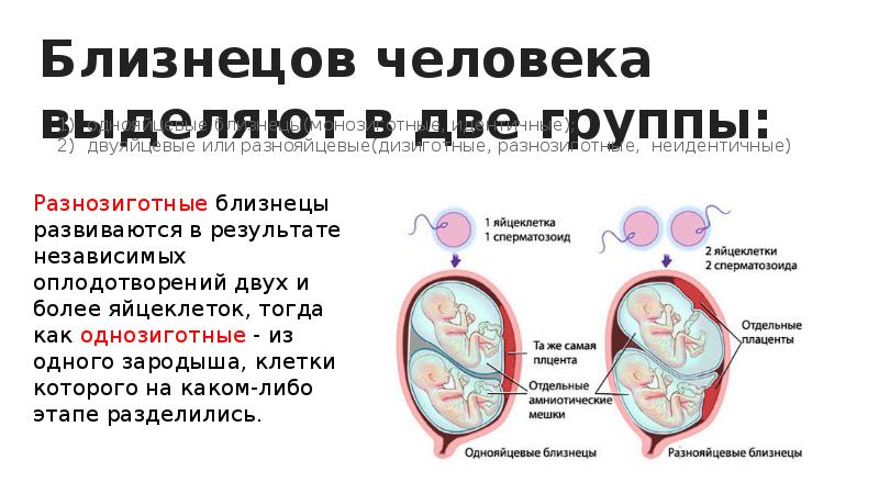 Однояйцевые близнецы