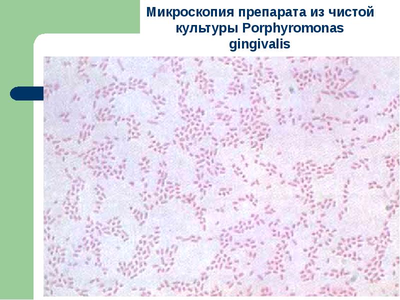 Porphyromonas gingivalis. Порфиромонас Гингивалис. Porphyromonas gingivalis окраска по Граму. Порфиромонас Гингивалис микробиология. Порфиромонас Гингивалис окраска по Граму.