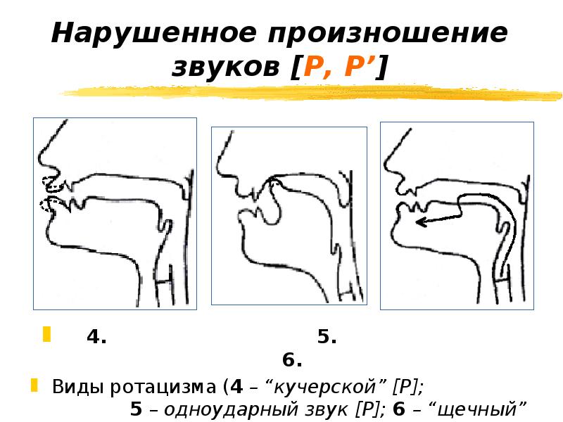 План логопедической работы по преодолению бокового ротацизма