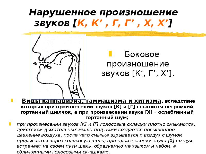 Могут ли немые издавать звуки. Произношение звуков. Нарушение произношения звуков. Нарушения произношения звука г. Неправильное произношение звука р.