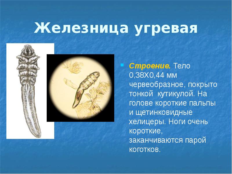 Железница угревая Строение. Тело  0,38X0,44 мм червеобразное, покрыто тонкой кутикулой.