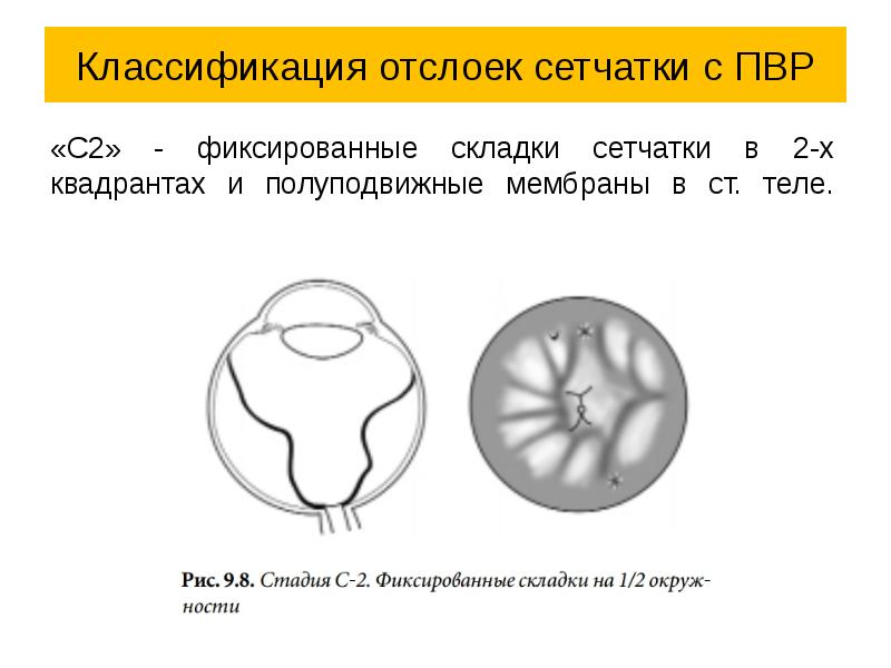 Какое изображение получается на сетчатке