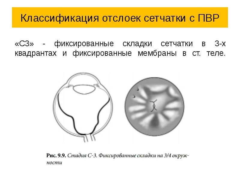 Как создается четкое изображение на сетчатке когда