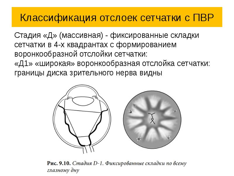 Как создается четкое изображение на сетчатке когда