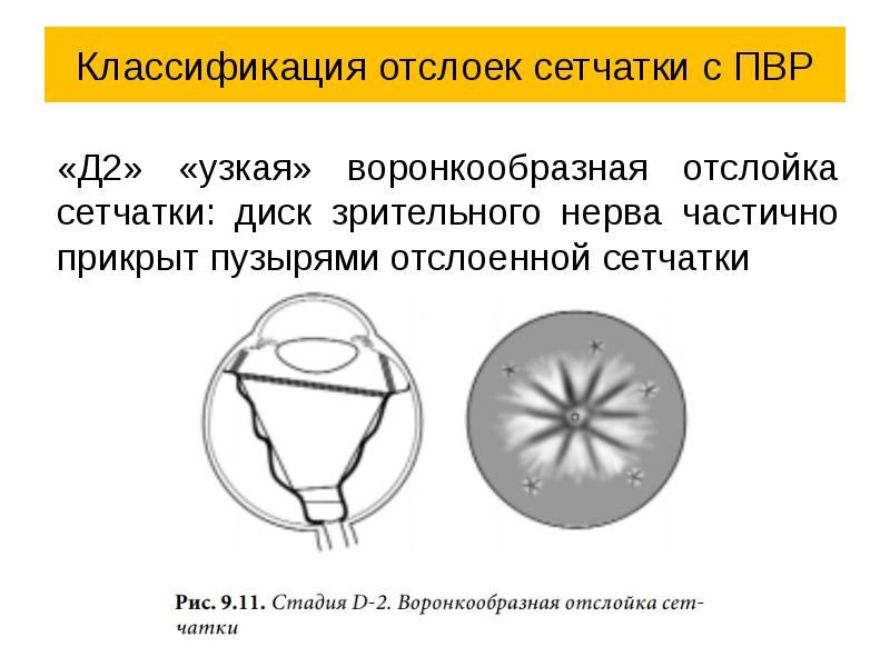 Как создается четкое изображение на сетчатке когда