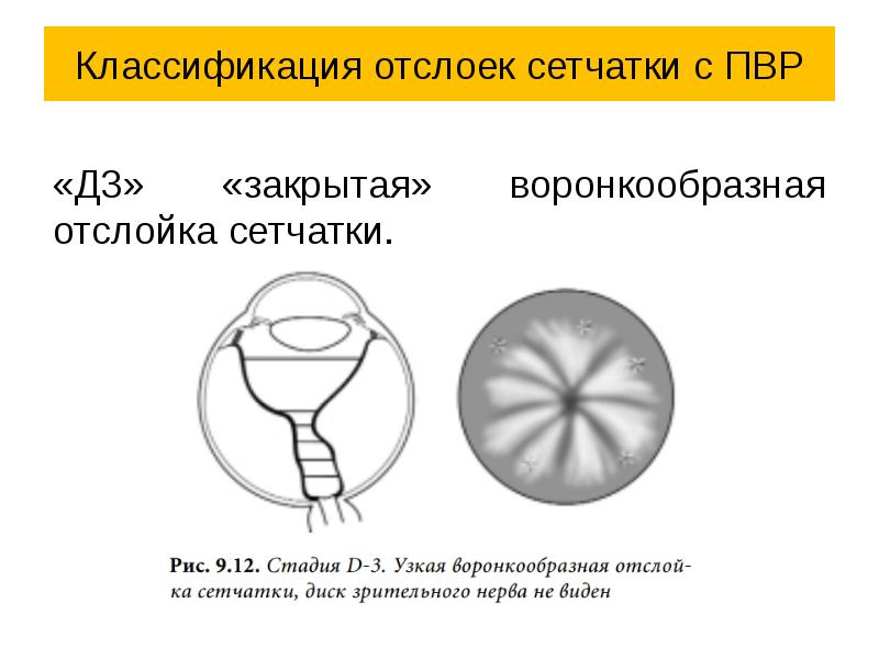 Как создается четкое изображение на сетчатке когда