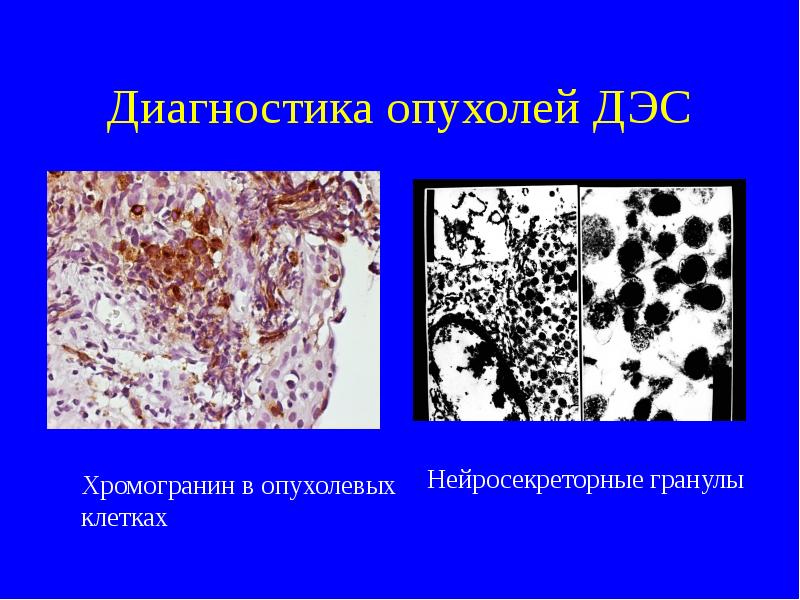 Презентация по опухолям