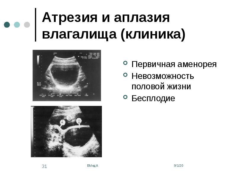 Аномалии развития женской репродуктивной системы презентация