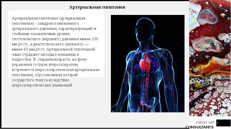 Артериальная гипотензия презентация