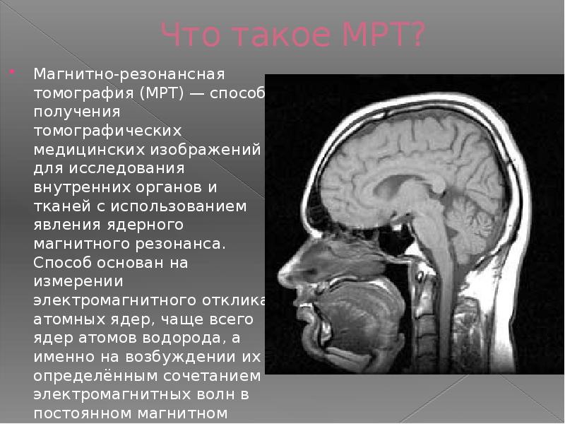 Особенности изображения органов и тканей на мр томограммах