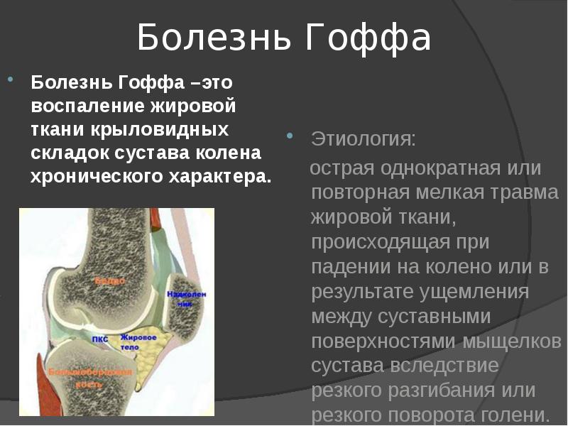 Диагностика заболеваний суставов презентация