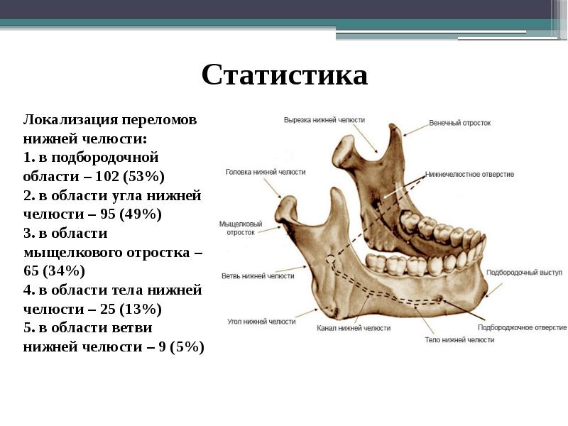 Закрытый перелом нижней челюсти карта вызова локальный статус