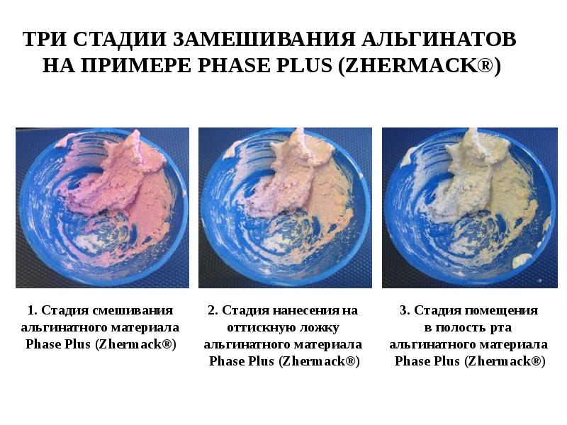 Оттискные материалы в ортопедической стоматологии