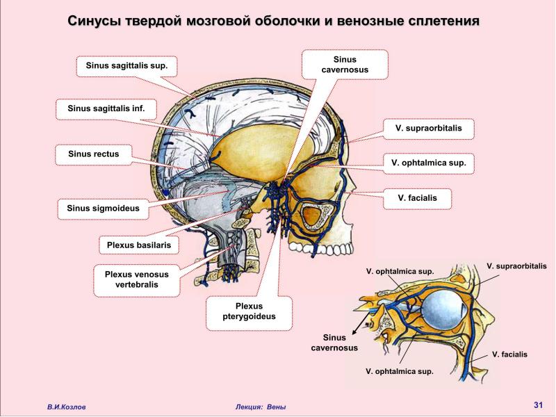 Схема венозных синусов головного мозга