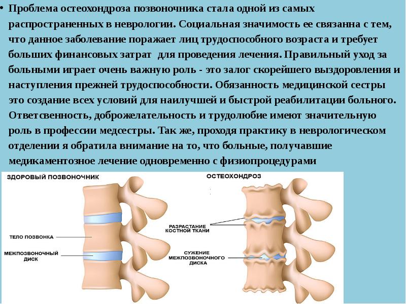 Шейный остеохондроз локальный статус карта вызова