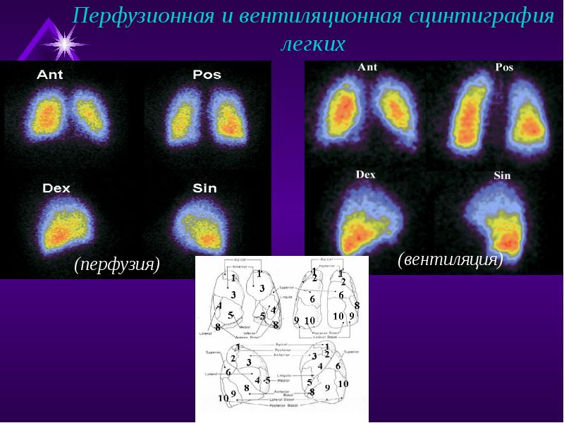 Сцинтиграфия схема получения изображения