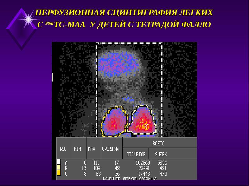 Радионуклидная диагностика презентация