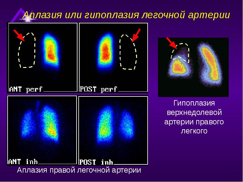 Радионуклидная диагностика презентация