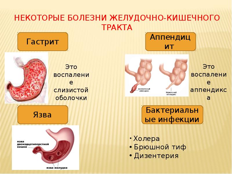 Некоторые болезни желудочно-кишечного тракта Некоторые болезни желудочно-кишечного тракта
