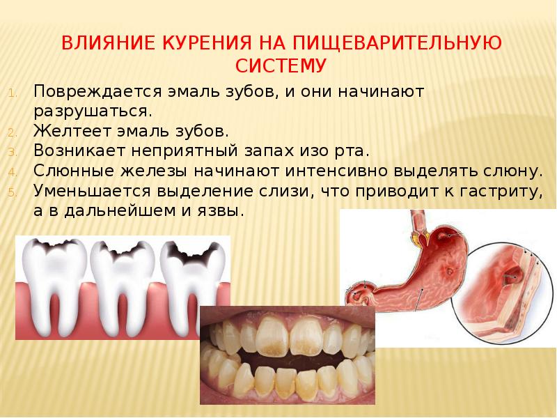Влияние курения на пищеварительную систему
Повреждается эмаль зубов, и они начинают Влияние курения на пищеварительную систему
Повреждается эмаль зубов, и они начинают