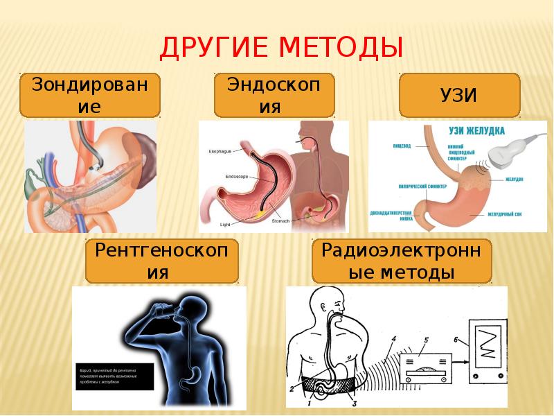Другие Методы Другие Методы