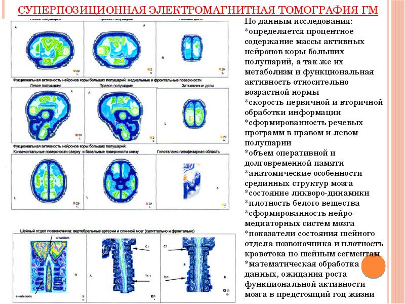 Особенности головного мозга детей