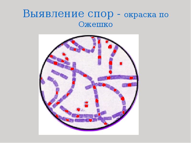 Окраска спор бактерий. Клостридии окраска по Ожешко. Окраска Ожешко Bacillus anthracis. Метод окраски Ожешко. Bacillus anthracis по Ожешко.