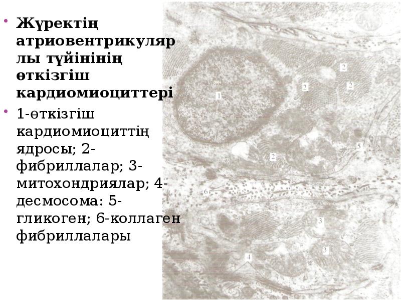 Жүректің атриовентрикулярлы түйінінің өткізгіш кардиомиоциттері
Жүректің атриовентрикулярлы түйінінің өткізгіш кардиомиоциттері
1-өткізгіш Жүректің атриовентрикулярлы түйінінің өткізгіш кардиомиоциттері
Жүректің атриовентрикулярлы түйінінің өткізгіш кардиомиоциттері
1-өткізгіш