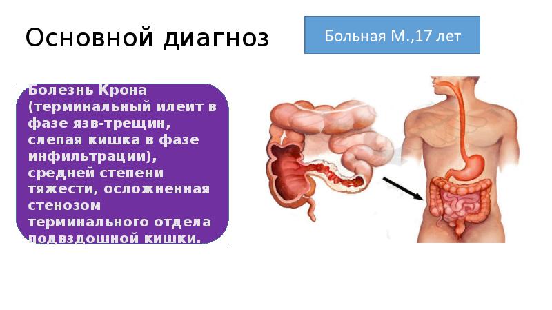 Рниму патологическая анатомия