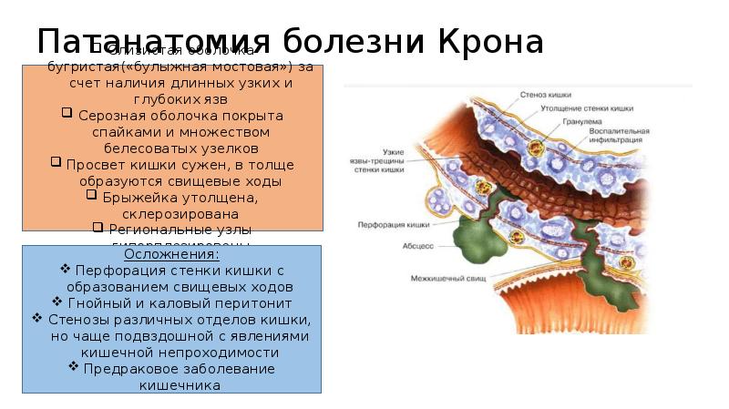 Рниму патологическая анатомия