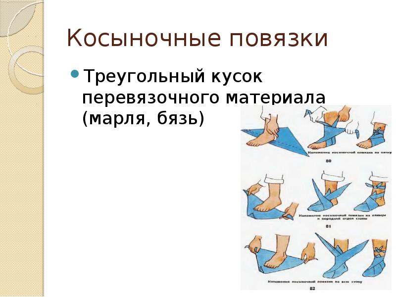 Косыночные повязки
Треугольный кусок перевязочного материала (марля, бязь) Косыночные повязки
Треугольный кусок перевязочного материала (марля, бязь)