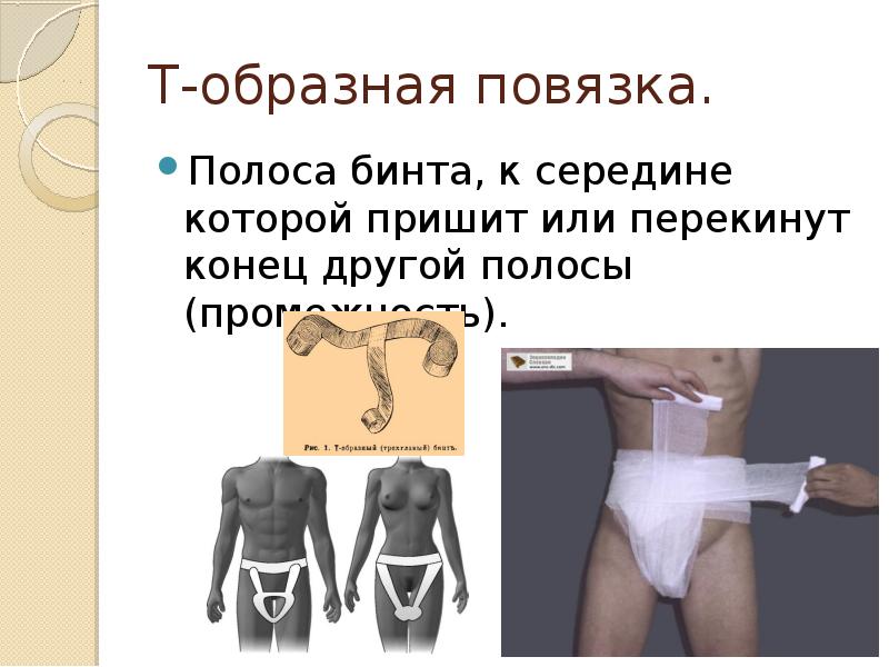 Т-образная повязка.
Полоса бинта, к середине которой пришит или перекинут конец Т-образная повязка.
Полоса бинта, к середине которой пришит или перекинут конец