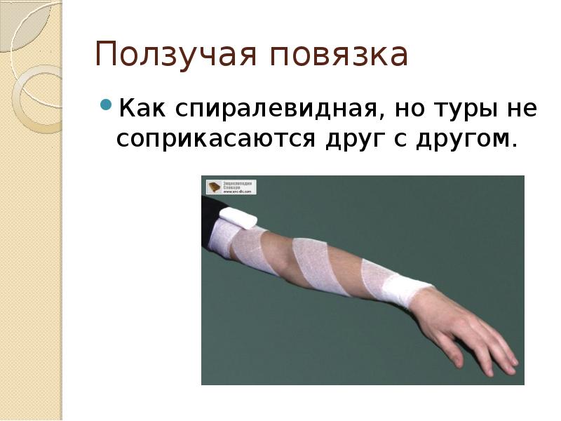 Ползучая повязка
Как спиралевидная, но туры не соприкасаются друг с другом. Ползучая повязка
Как спиралевидная, но туры не соприкасаются друг с другом.