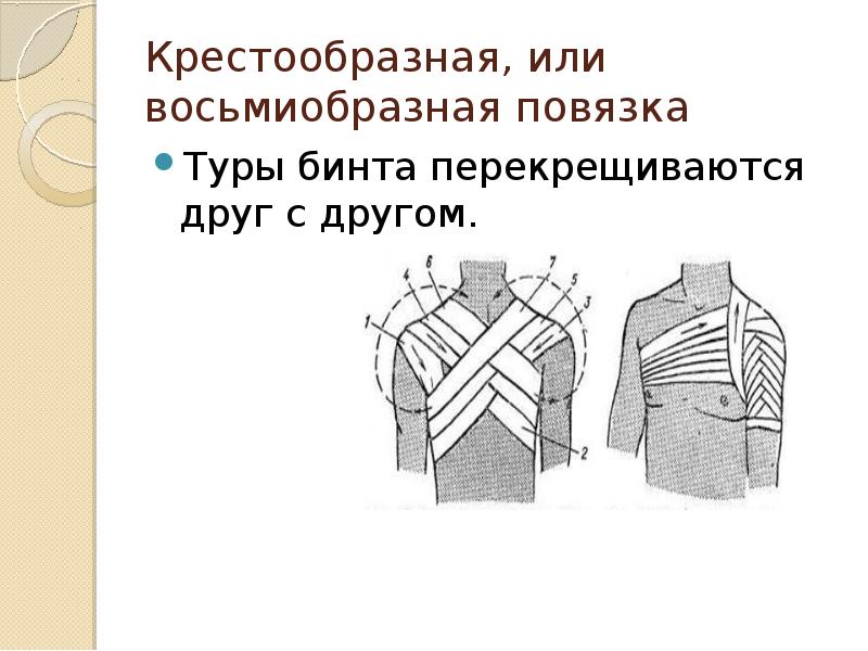 Десмургия лекция по хирургии для медсестер презентация