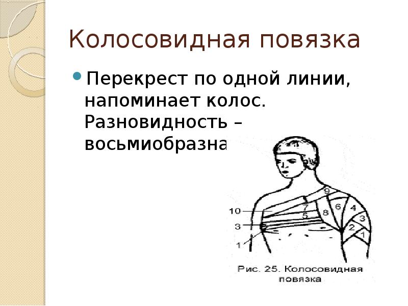 Колосовидная повязка
Перекрест по одной линии, напоминает колос. Разновидность – восьмиобразная. Колосовидная повязка
Перекрест по одной линии, напоминает колос. Разновидность – восьмиобразная.