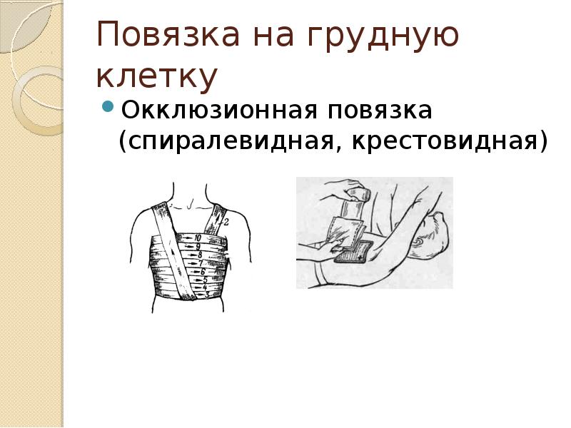 Повязка на грудную клетку
Окклюзионная повязка (спиралевидная, крестовидная) Повязка на грудную клетку
Окклюзионная повязка (спиралевидная, крестовидная)