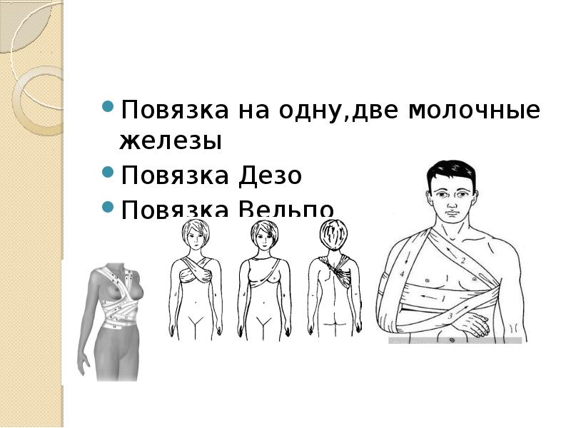 Повязка на молочную железу. Повязка на две молочные железы. Десмургия повязка на молочную железу. Косыночная повязка на молочную железу. Повязка на одну две молочные железы.