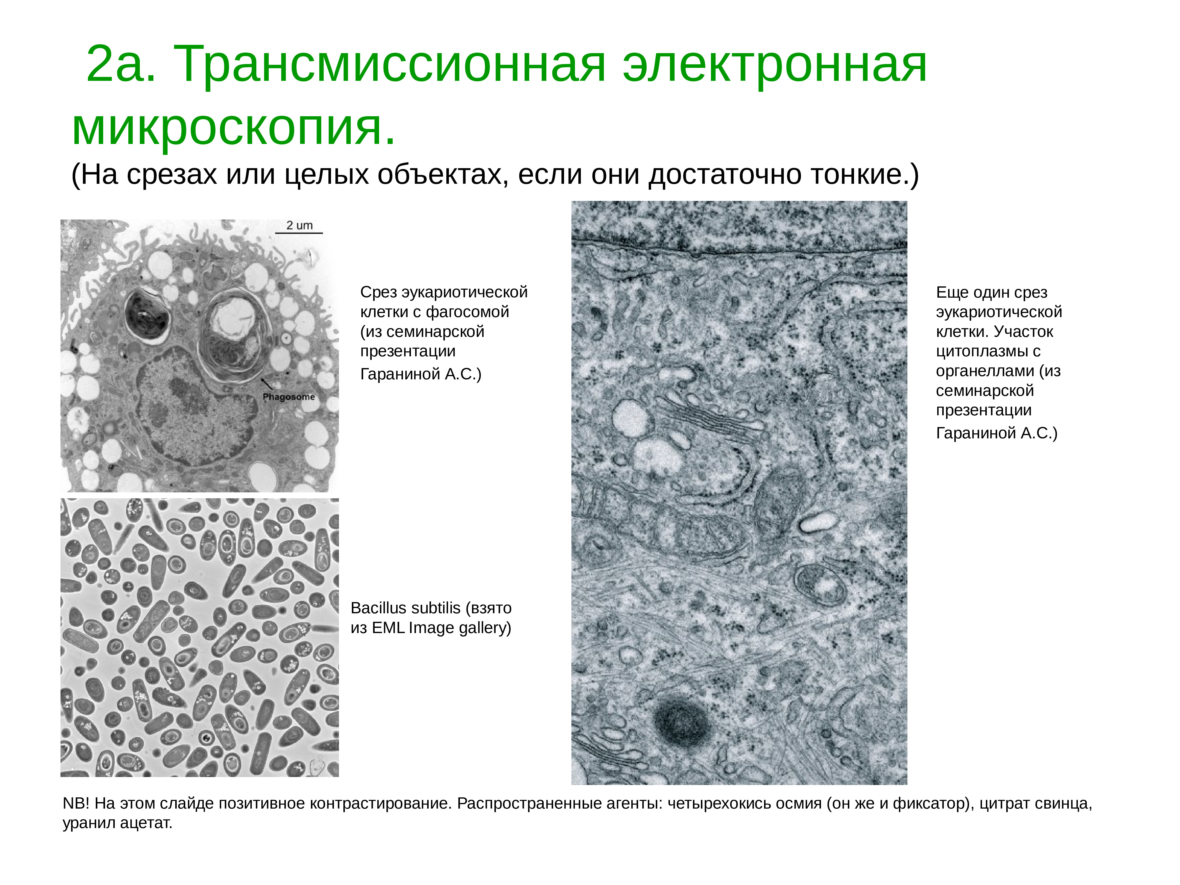 Микроскопия что это. Трансмиссионная и сканирующая микроскопия. Трансмиссионная электронная микроскопия. Сканирующий и трансмиссионный микроскоп. Трансмиссионный электронный микроскоп.