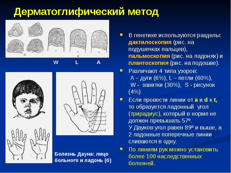 Метод дерматоглифики в генетике презентация